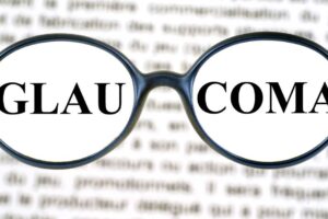 Glaucoma: Symptoms & Risk Factors featured image