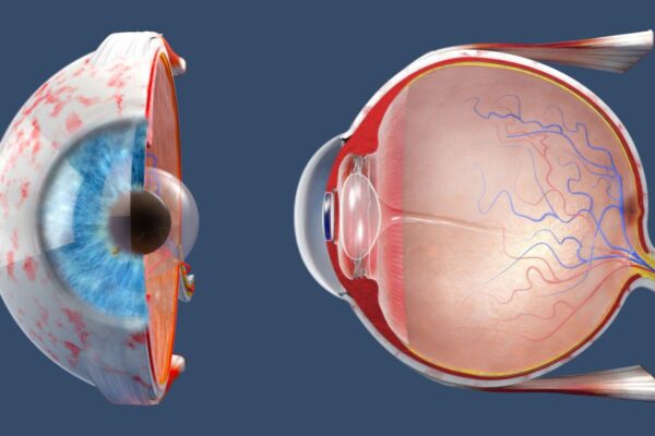 Retina Care Pembroke Pines featured image