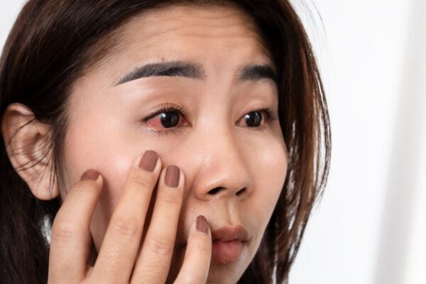 Red, Itchy, or Dry? Breaking Down Common Causes of Eye Irritation featured image